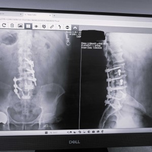 CRW Spine 25